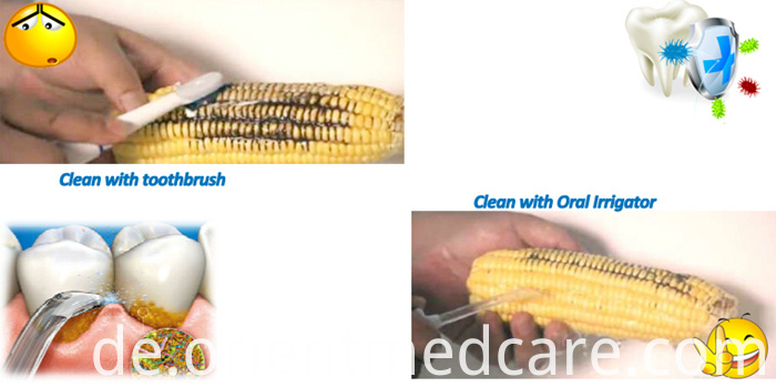 Revolution of oral water flosser Revolution of oral water flosser